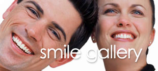 smile galllery - before and after cosmetic dentistry